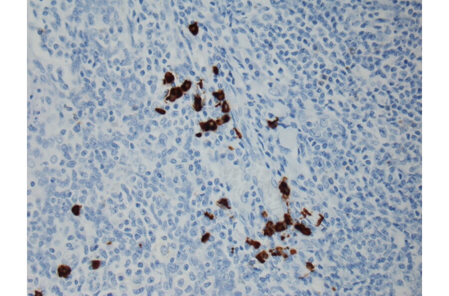 Immunohistochemistry - Anti-Human IgG3 Antibody [RM119] (A121339) - Antibodies.com