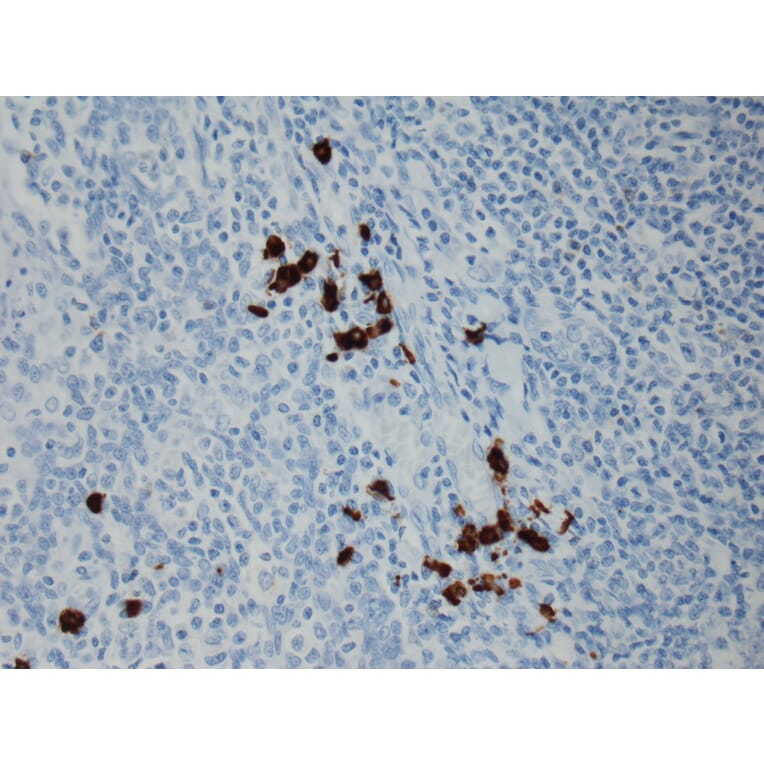 Immunohistochemistry - Anti-Human IgG3 Antibody [RM119] (A121339) - Antibodies.com