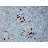 Immunohistochemistry - Anti-Human IgG3 Antibody [RM119] (A121339) - Antibodies.com