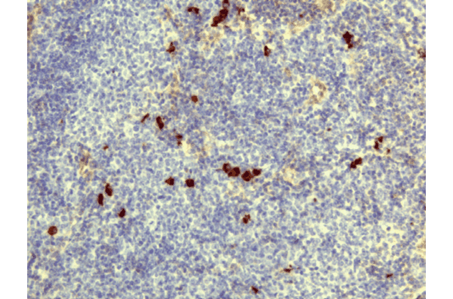 Immunohistochemistry - Anti-Human IgD Antibody [RM123] (A121347) - Antibodies.com