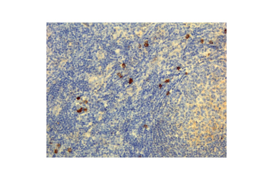 Immunohistochemistry - Anti-Human IgG4 Antibody [RM120] (A121351) - Antibodies.com
