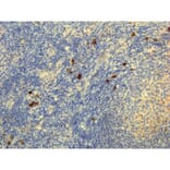 Immunohistochemistry - Anti-Human IgG4 Antibody [RM120] (A121351) - Antibodies.com