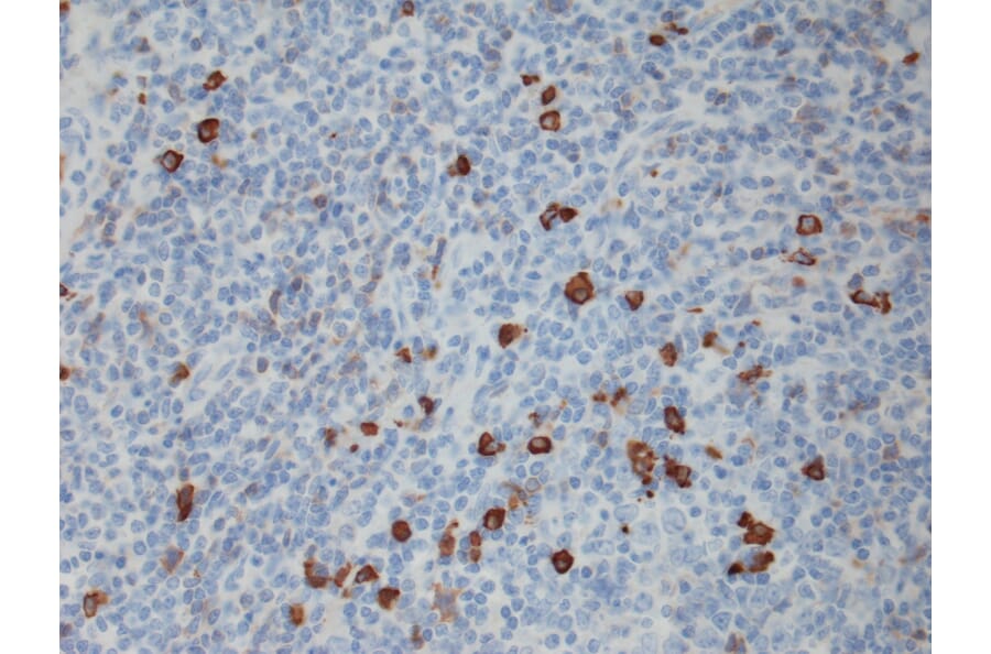 Immunohistochemistry - Anti-Human IgG4 Antibody [RM120] (A121351) - Antibodies.com