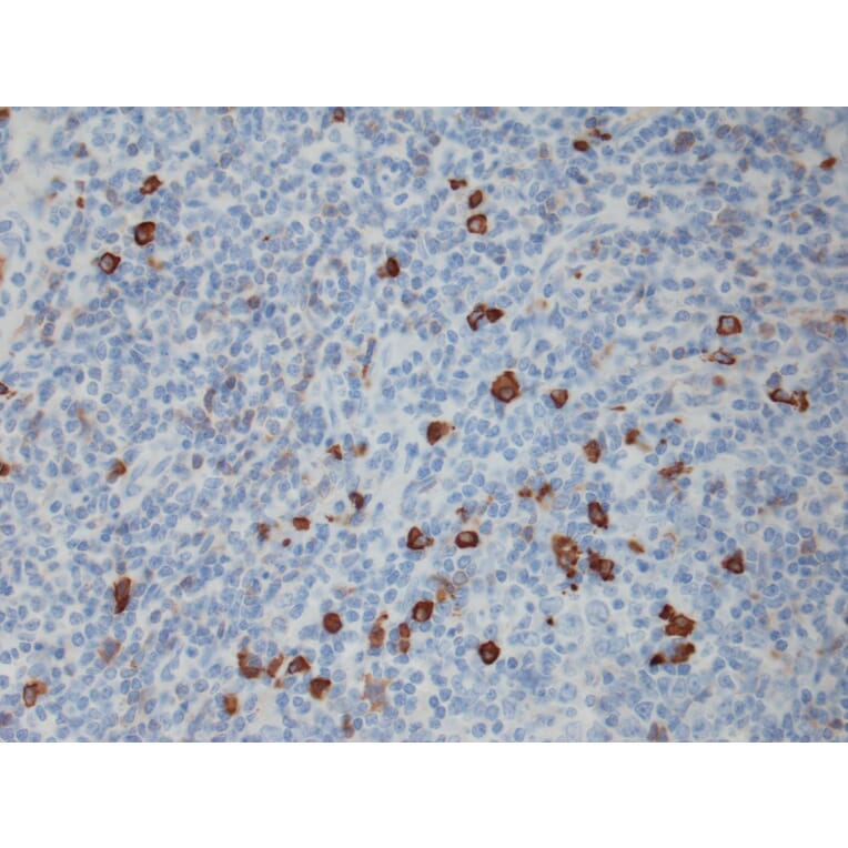 Immunohistochemistry - Anti-Human IgG4 Antibody [RM120] (A121351) - Antibodies.com