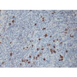 Immunohistochemistry - Anti-Human IgG4 Antibody [RM120] (A121351) - Antibodies.com