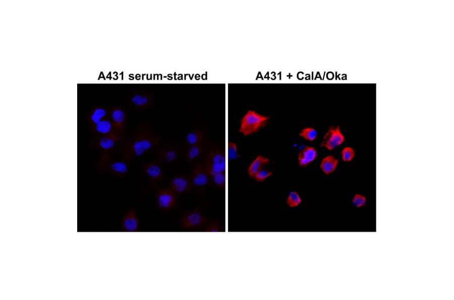 Immunocytochemistry - Anti-Phosphothreonine Antibody [RM102] (A121290) - Antibodies.com