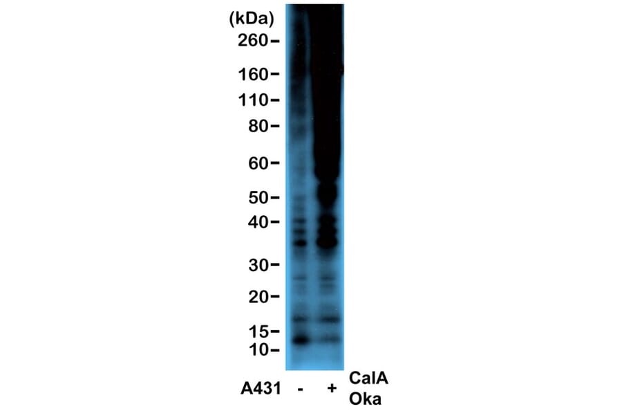 Western Blot - Anti-Phosphothreonine Antibody [RM102] (A121354) - Antibodies.com