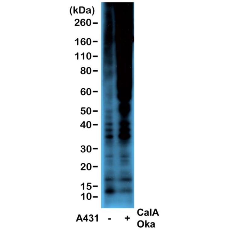 Western Blot - Anti-Phosphothreonine Antibody [RM102] (A121354) - Antibodies.com
