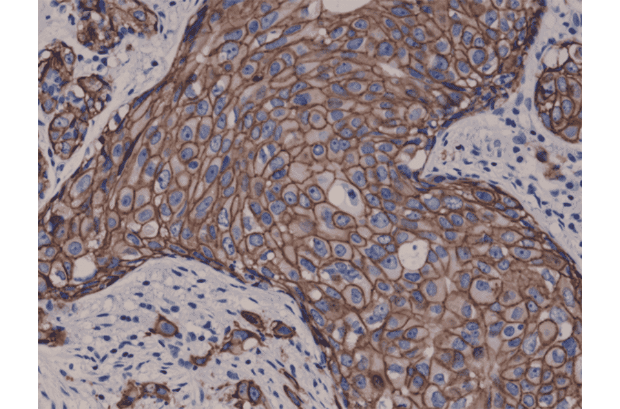 Immunohistochemistry - Anti-ErbB 2 Antibody [RM228] (A121361) - Antibodies.com