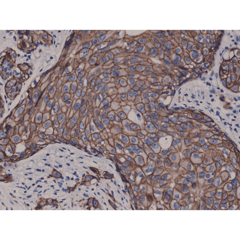 Immunohistochemistry - Anti-ErbB 2 Antibody [RM228] (A121361) - Antibodies.com