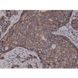 Immunohistochemistry - Anti-ErbB 2 Antibody [RM228] (A121361) - Antibodies.com
