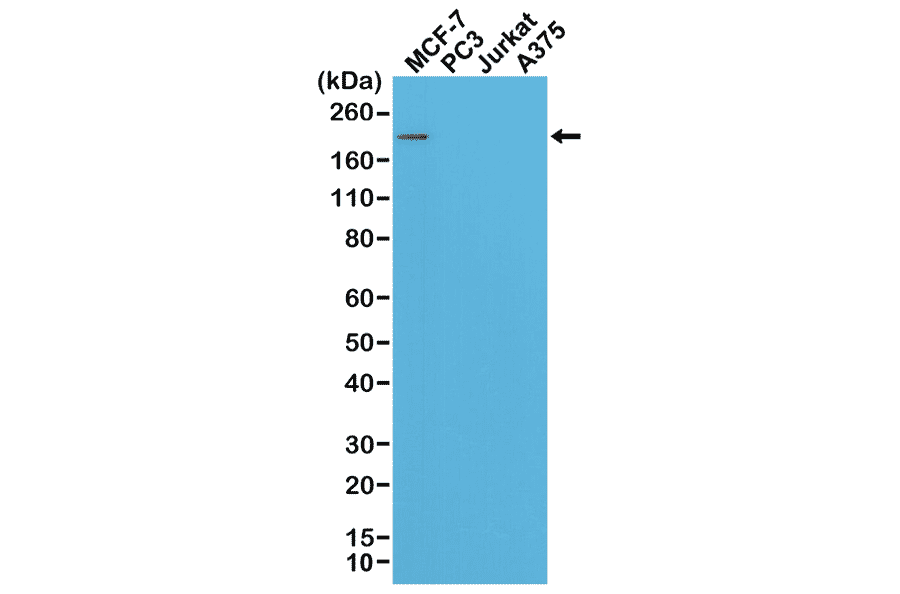 Western Blot - Anti-ErbB 2 Antibody [RM228] (A121360) - Antibodies.com