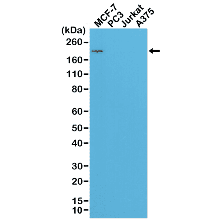 Western Blot - Anti-ErbB 2 Antibody [RM228] (A121360) - Antibodies.com