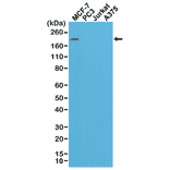Western Blot - Anti-ErbB 2 Antibody [RM228] (A121360) - Antibodies.com