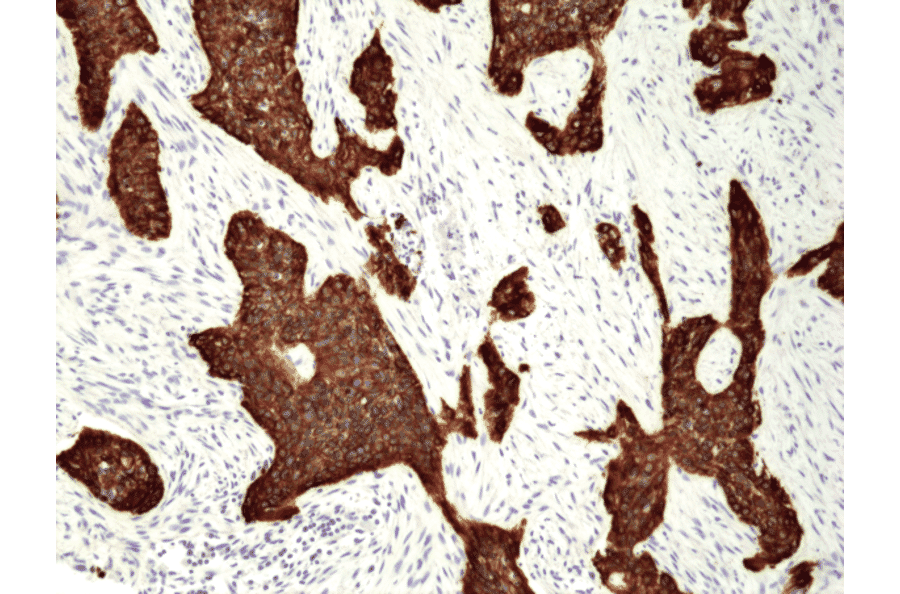 Immunohistochemistry - Anti-Cytokeratin 5 Antibody [RM226] (A121361) - Antibodies.com