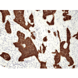 Immunohistochemistry - Anti-Cytokeratin 5 Antibody [RM226] (A121361) - Antibodies.com