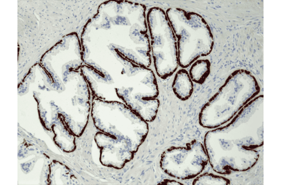 Immunohistochemistry - Anti-Cytokeratin 5 Antibody [RM226] (A121361) - Antibodies.com