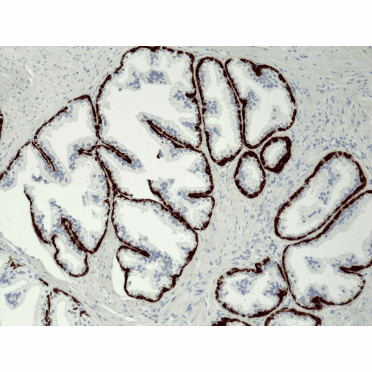 Immunohistochemistry - Anti-Cytokeratin 5 Antibody [RM226] (A121361) - Antibodies.com