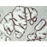 Immunohistochemistry - Anti-Cytokeratin 5 Antibody [RM226] (A121361) - Antibodies.com