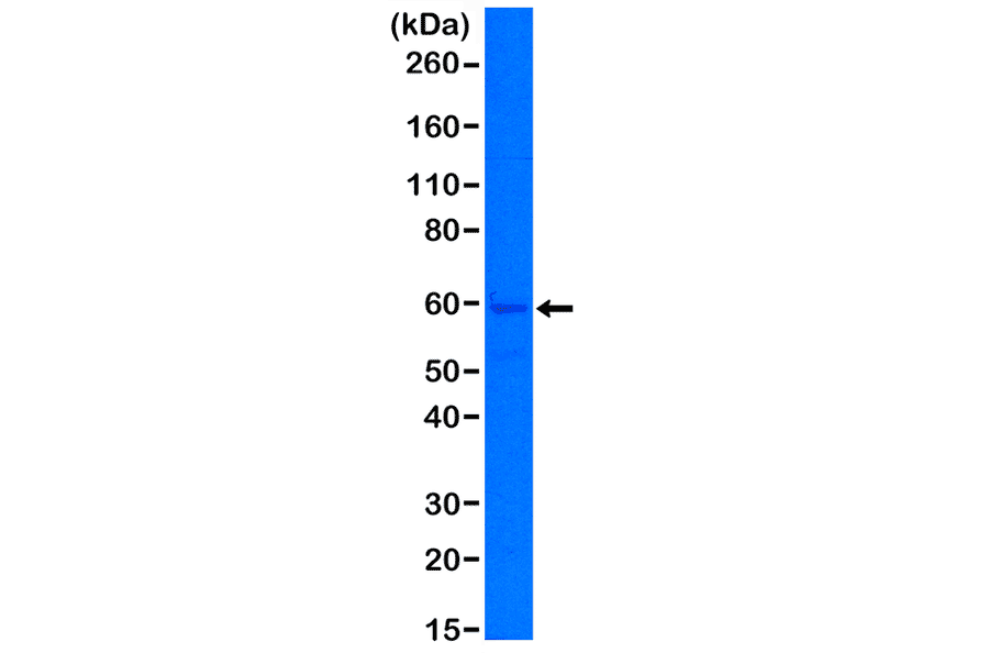 Western Blot - Anti-Cytokeratin 5 Antibody [RM226] (A121244) - Antibodies.com