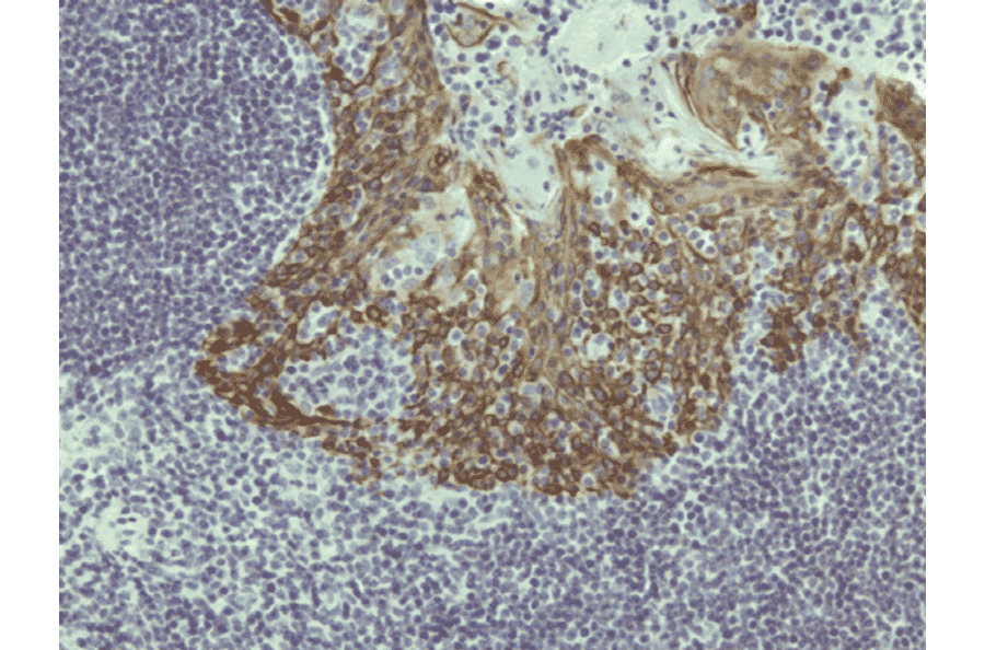 Immunohistochemistry - Anti-Cytokeratin 5 Antibody [RM226] (A121361) - Antibodies.com