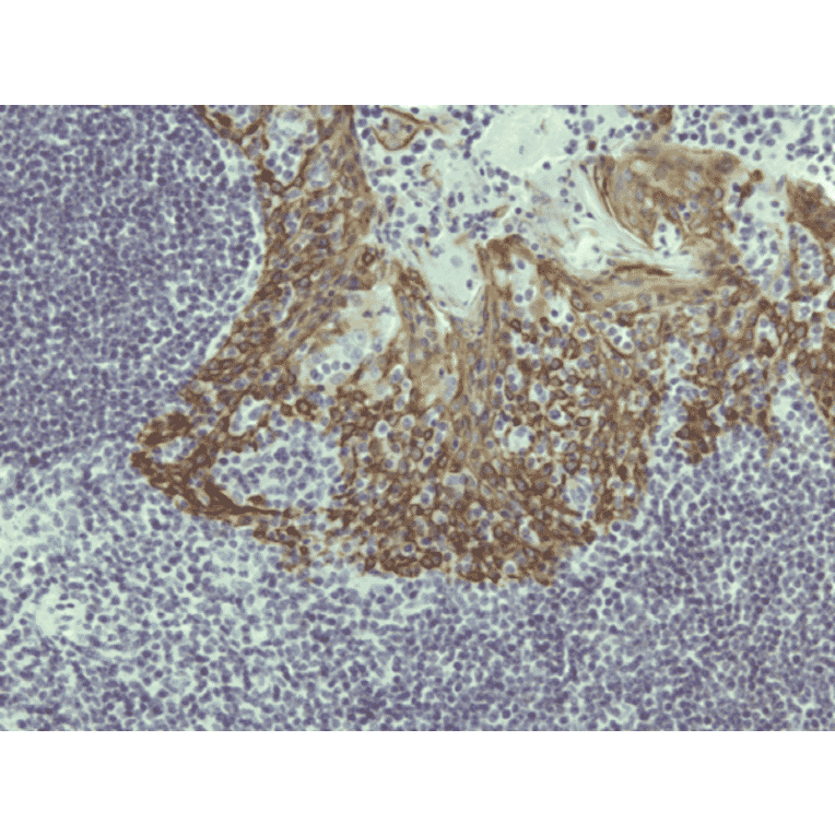 Immunohistochemistry - Anti-Cytokeratin 5 Antibody [RM226] (A121361) - Antibodies.com