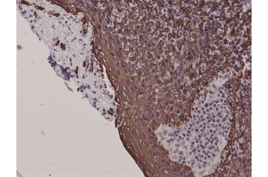 Immunohistochemistry - Anti-Cytokeratin 5 Antibody [RM226] (A121361) - Antibodies.com