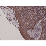 Immunohistochemistry - Anti-Cytokeratin 5 Antibody [RM226] (A121361) - Antibodies.com