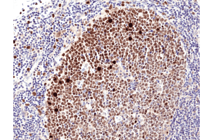 Immunohistochemistry - Anti-Ki67 Antibody [RM360] (A121476) - Antibodies.com