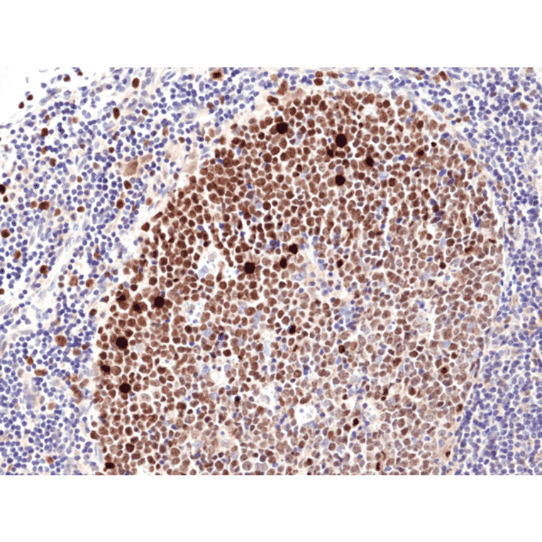 Immunohistochemistry - Anti-Ki67 Antibody [RM360] (A121476) - Antibodies.com