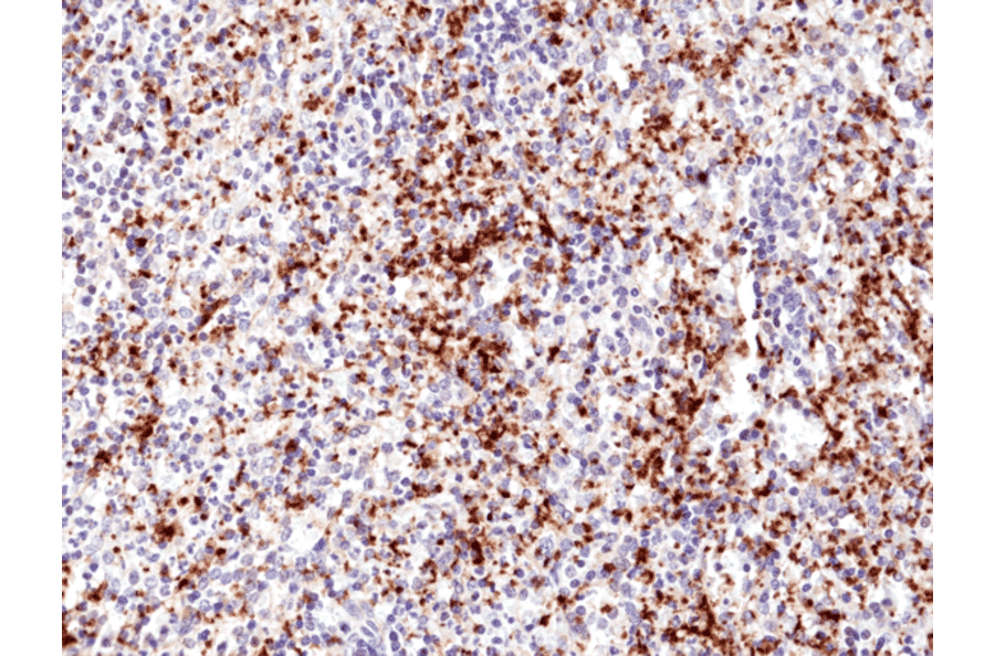 Immunohistochemistry - Anti-Integrin beta 3 Antibody [RM382] (A121453) - Antibodies.com