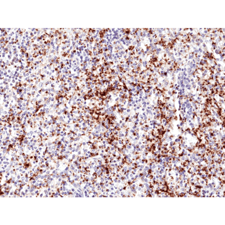Immunohistochemistry - Anti-Integrin beta 3 Antibody [RM382] (A121453) - Antibodies.com