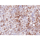 Immunohistochemistry - Anti-Integrin beta 3 Antibody [RM382] (A121453) - Antibodies.com