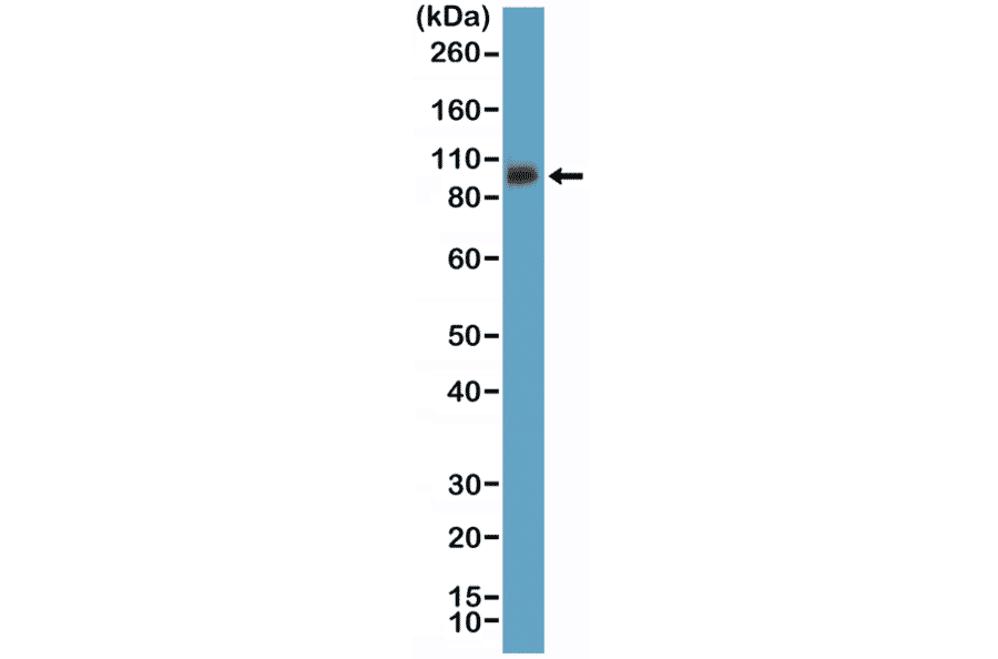 Western Blot - Anti-Integrin beta 3 Antibody [RM382] (A121363) - Antibodies.com