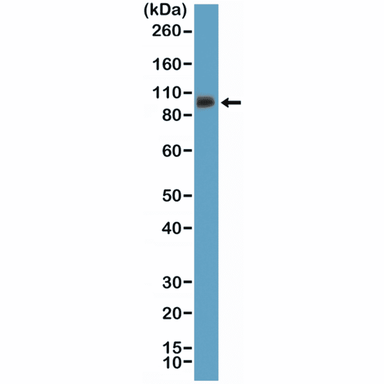 Western Blot - Anti-Integrin beta 3 Antibody [RM382] (A121363) - Antibodies.com
