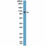 Western Blot - Anti-Integrin beta 3 Antibody [RM382] (A121363) - Antibodies.com
