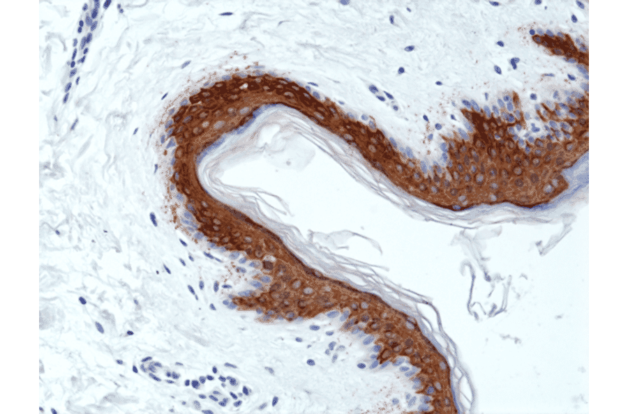 Immunohistochemistry - Anti-Cytokeratin 10 Antibody [RM386] (A121365) - Antibodies.com