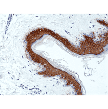 Immunohistochemistry - Anti-Cytokeratin 10 Antibody [RM386] (A121365) - Antibodies.com