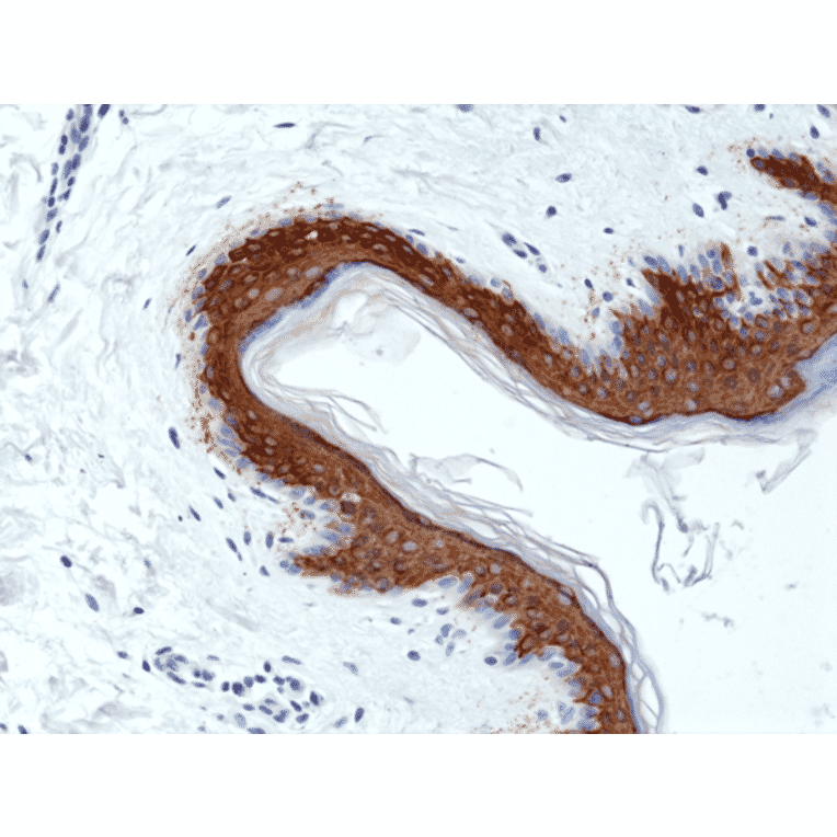 Immunohistochemistry - Anti-Cytokeratin 10 Antibody [RM386] (A121365) - Antibodies.com