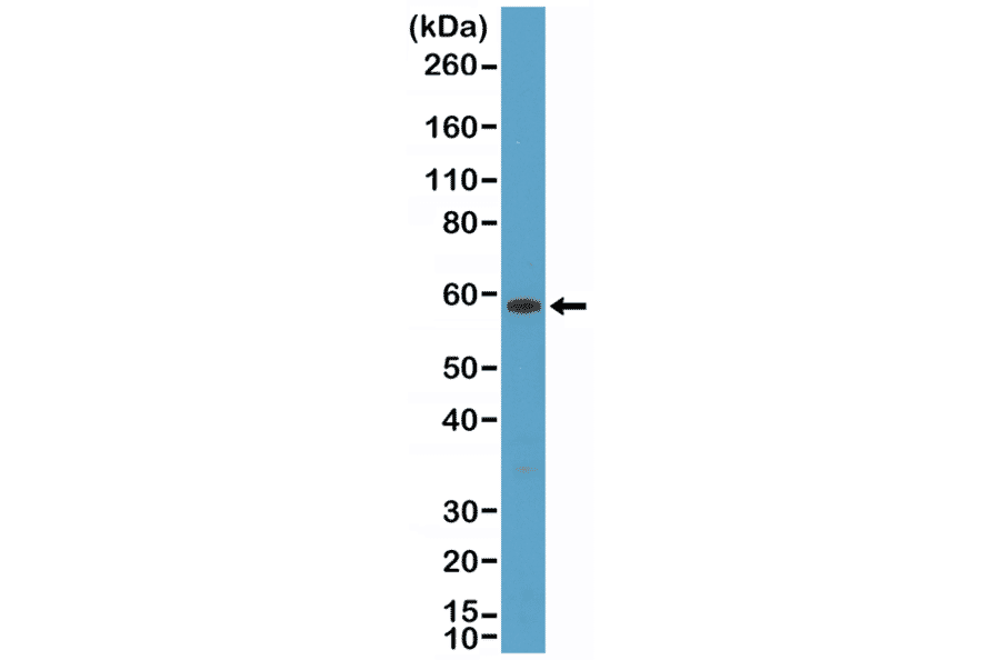 Western Blot - Anti-Cytokeratin 10 Antibody [RM386] (A121364) - Antibodies.com