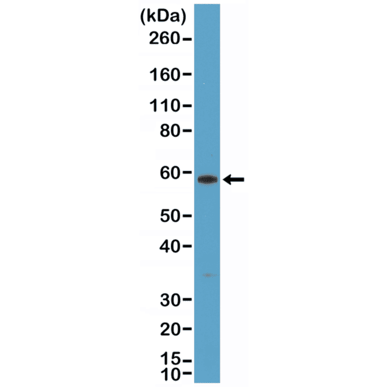 Western Blot - Anti-Cytokeratin 10 Antibody [RM386] (A121364) - Antibodies.com