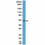 Western Blot - Anti-Cytokeratin 10 Antibody [RM386] (A121364) - Antibodies.com