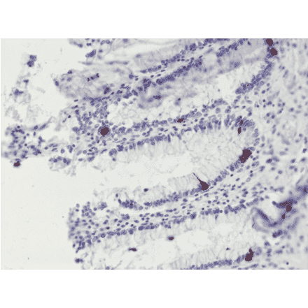 Immunohistochemistry - Anti-Chromogranin A Antibody [RM385] (A121365) - Antibodies.com