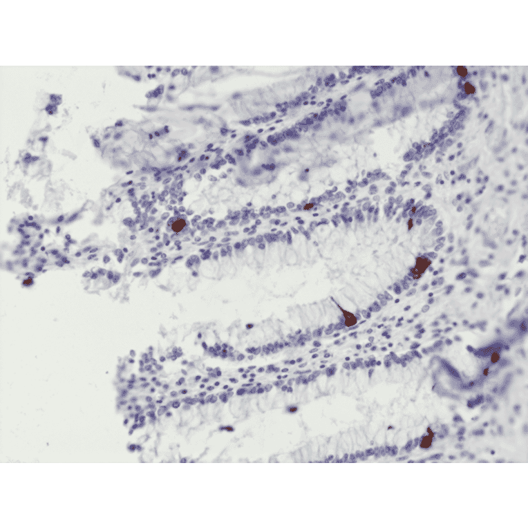 Immunohistochemistry - Anti-Chromogranin A Antibody [RM385] (A121365) - Antibodies.com