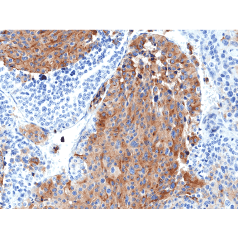 Immunohistochemistry - Anti-Chromogranin A Antibody [RM385] (A121366) - Antibodies.com