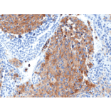 Immunohistochemistry - Anti-Chromogranin A Antibody [RM385] (A121366) - Antibodies.com