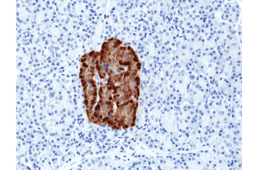 Immunohistochemistry - Anti-Chromogranin A Antibody [RM385] (A121365) - Antibodies.com