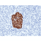 Immunohistochemistry - Anti-Chromogranin A Antibody [RM385] (A121365) - Antibodies.com