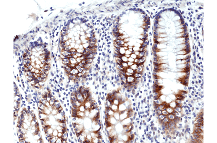 Immunohistochemistry - Anti-CD71 Antibody [RM384] (A121442) - Antibodies.com