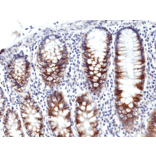 Immunohistochemistry - Anti-CD71 Antibody [RM384] (A121442) - Antibodies.com